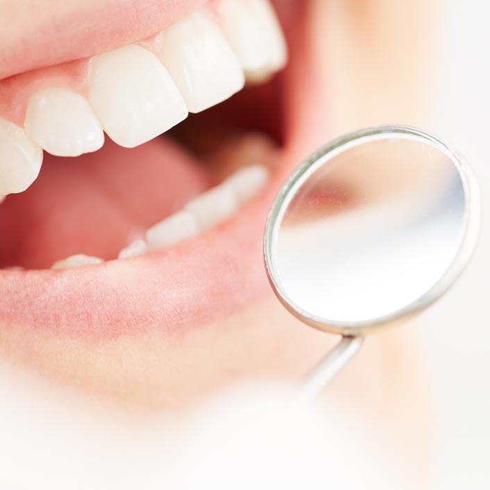 Dental Cleaning - Dental Services