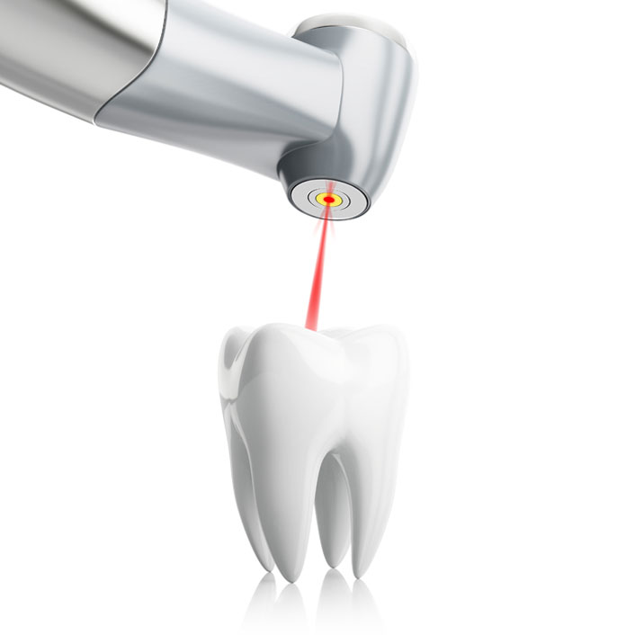 Laser Dentistry - Dental Technology